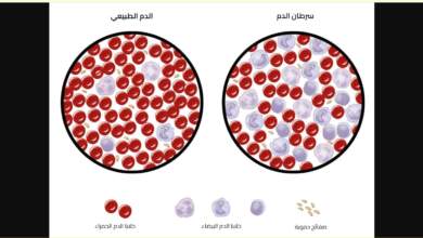 الفرق بين الدم السليم والمصاب بالسرطان