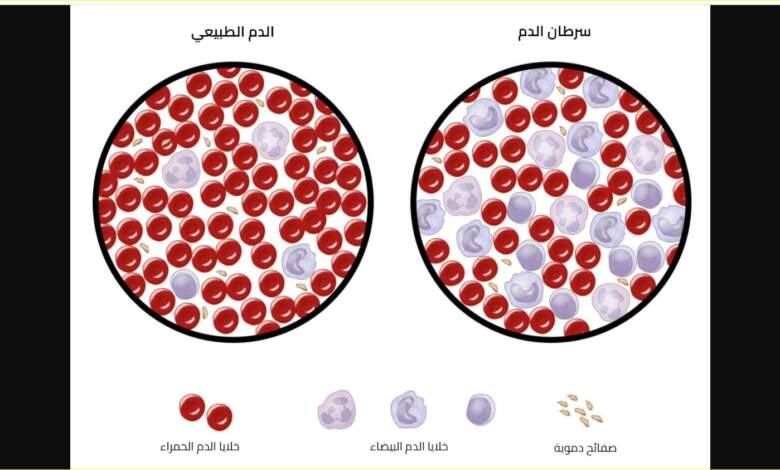 الفرق بين الدم السليم والمصاب بالسرطان