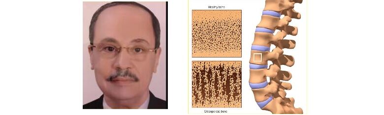 أمراض العظام.. وإلى اليسار د. محمد إبراهيم بسيوني