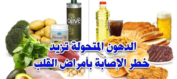 الدهون المتحولة